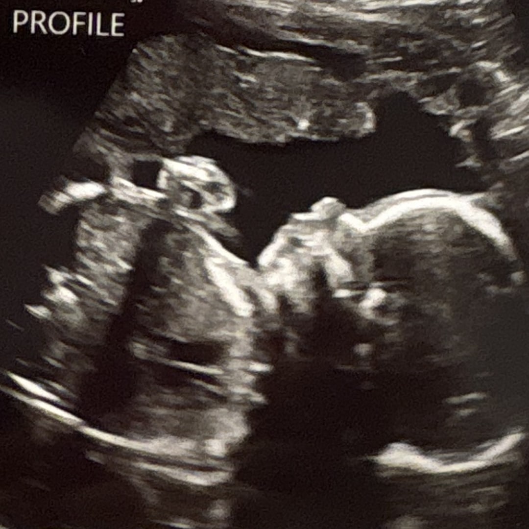 Photo shared by Isabel for their Babylist baby registry.