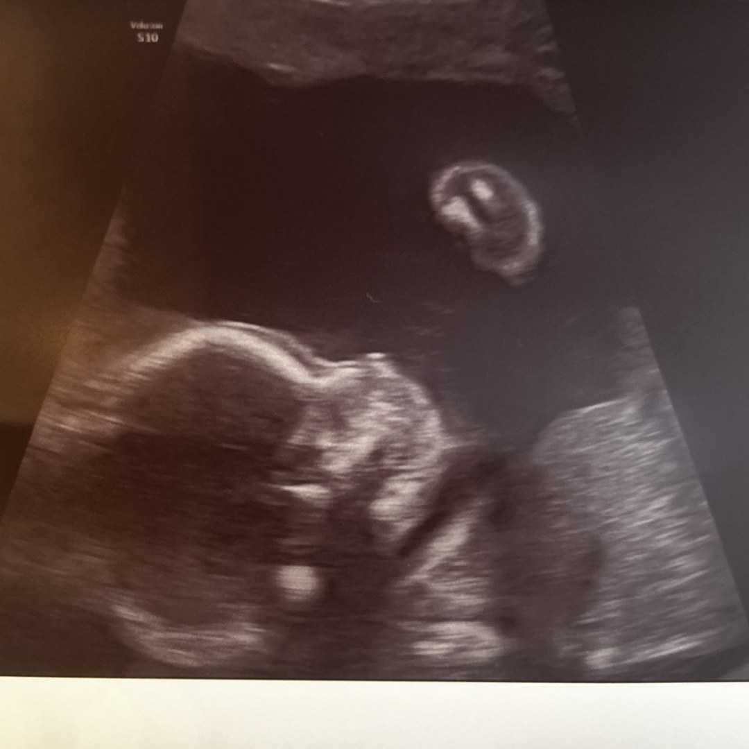 Photo shared by Ethanna for their Babylist baby registry.
