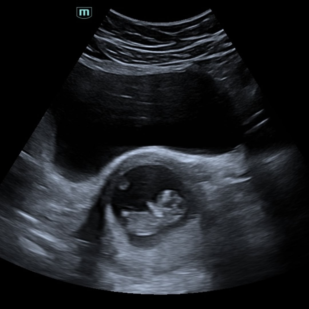 Photo shared by Jade for their Babylist baby registry.