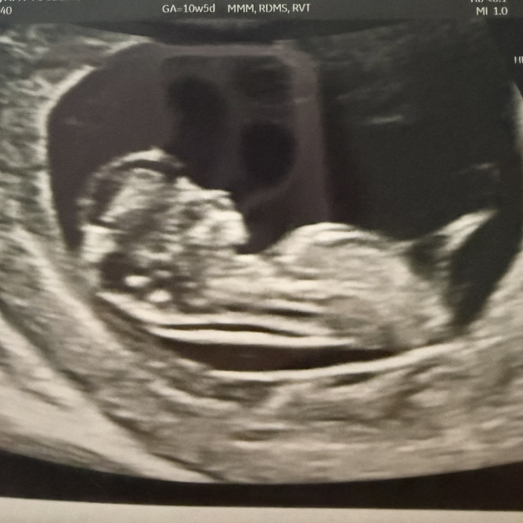 Photo shared by Amy for their Babylist baby registry.