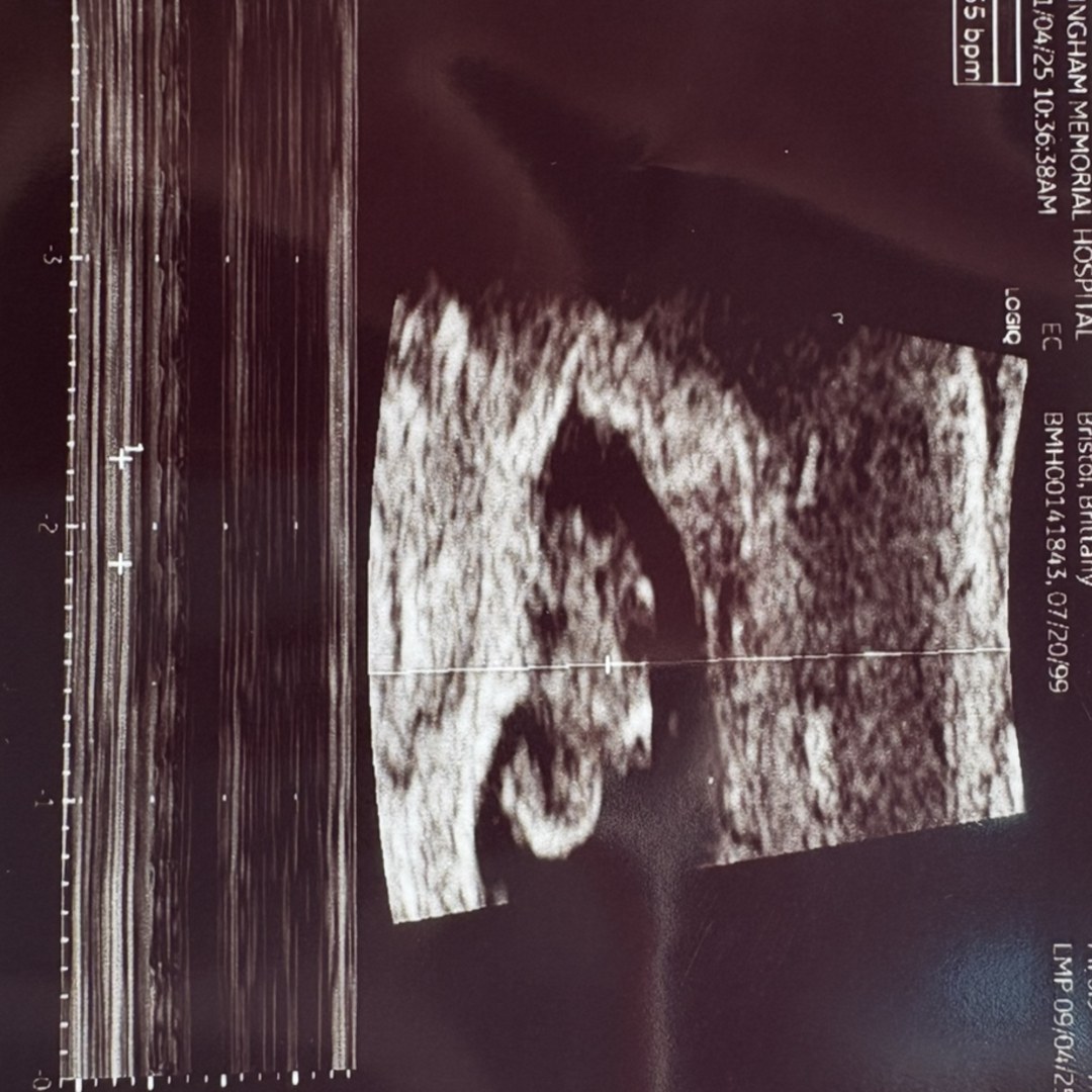 Photo shared by Brittany for their Babylist baby registry.