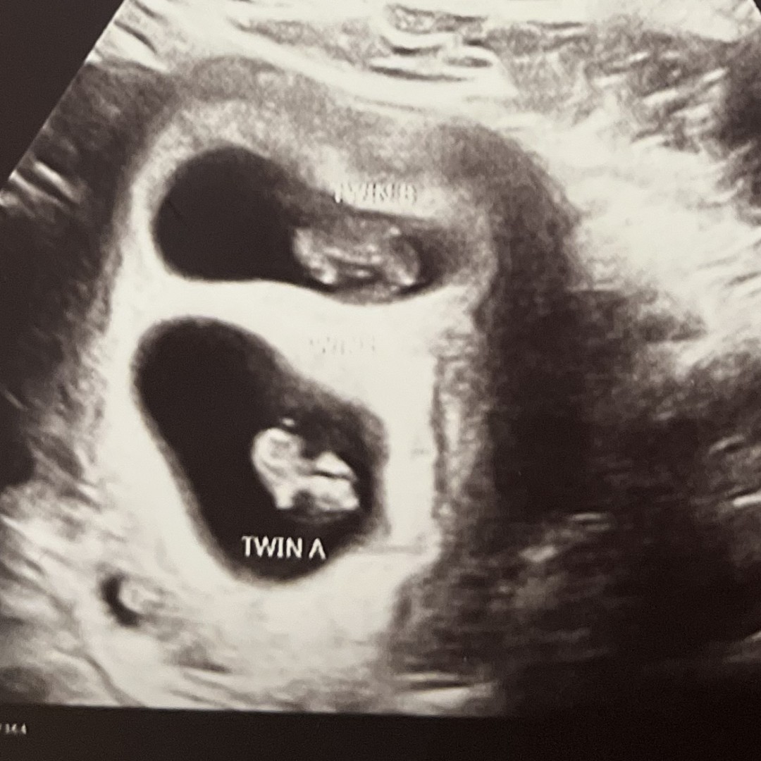 Photo shared by Madison for their Babylist baby registry.