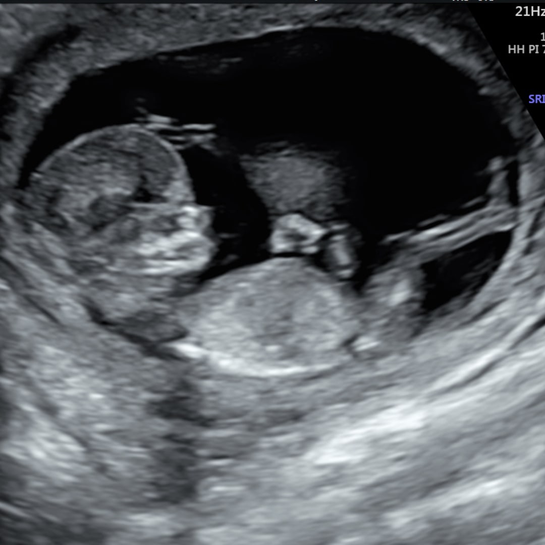 Photo shared by Molly for their Babylist baby registry.