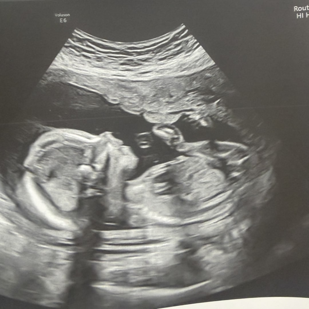 Photo shared by Candis for their Babylist baby registry.
