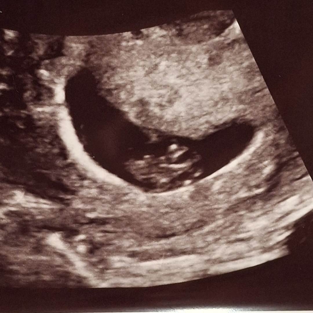 Photo shared by Hailey for their Babylist baby registry.