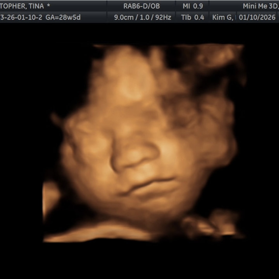 Photo shared by Tina for their Babylist baby registry.