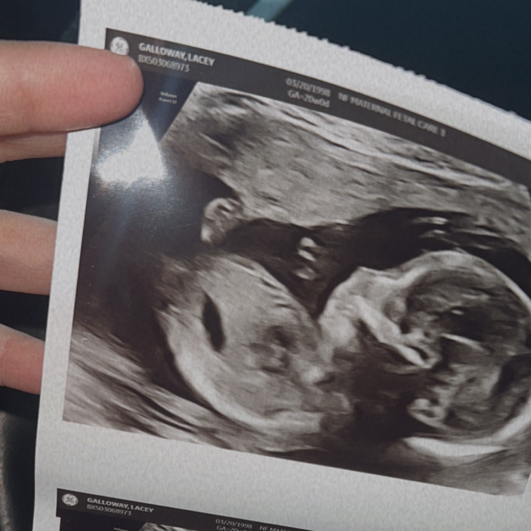 Photo shared by Lacey for their Babylist baby registry.