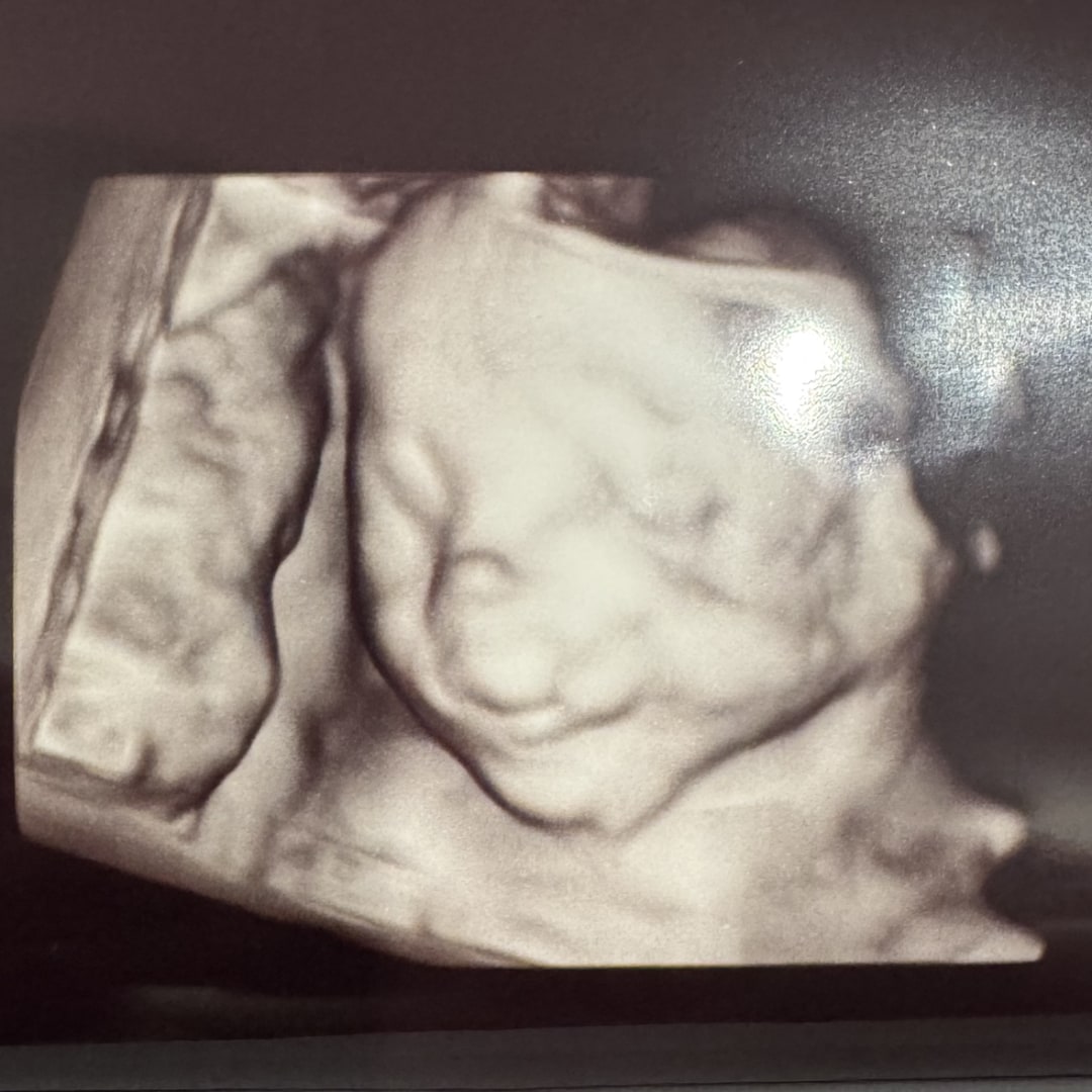 Photo shared by Sierra for their Babylist baby registry.