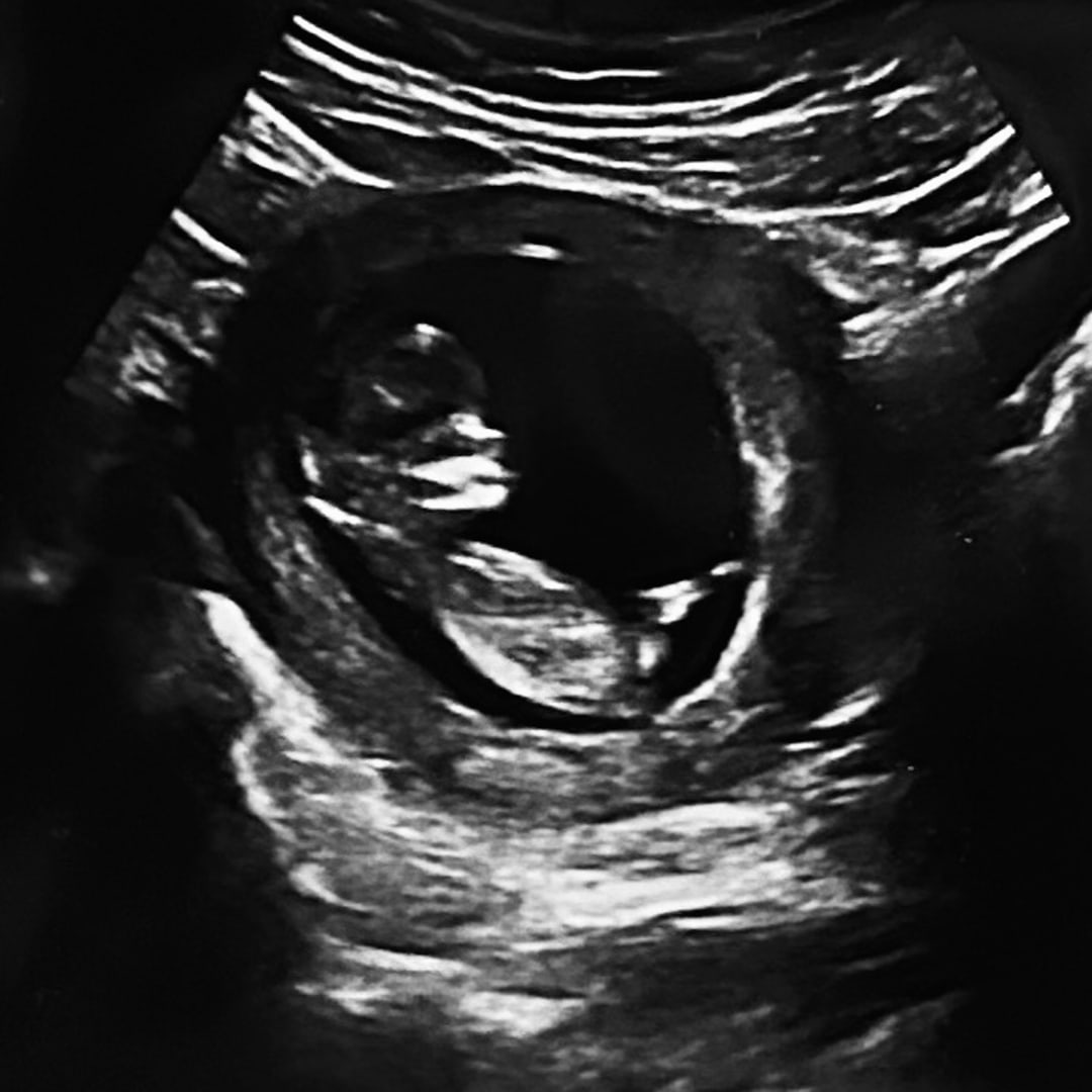 Photo shared by Trinity for their Babylist baby registry.