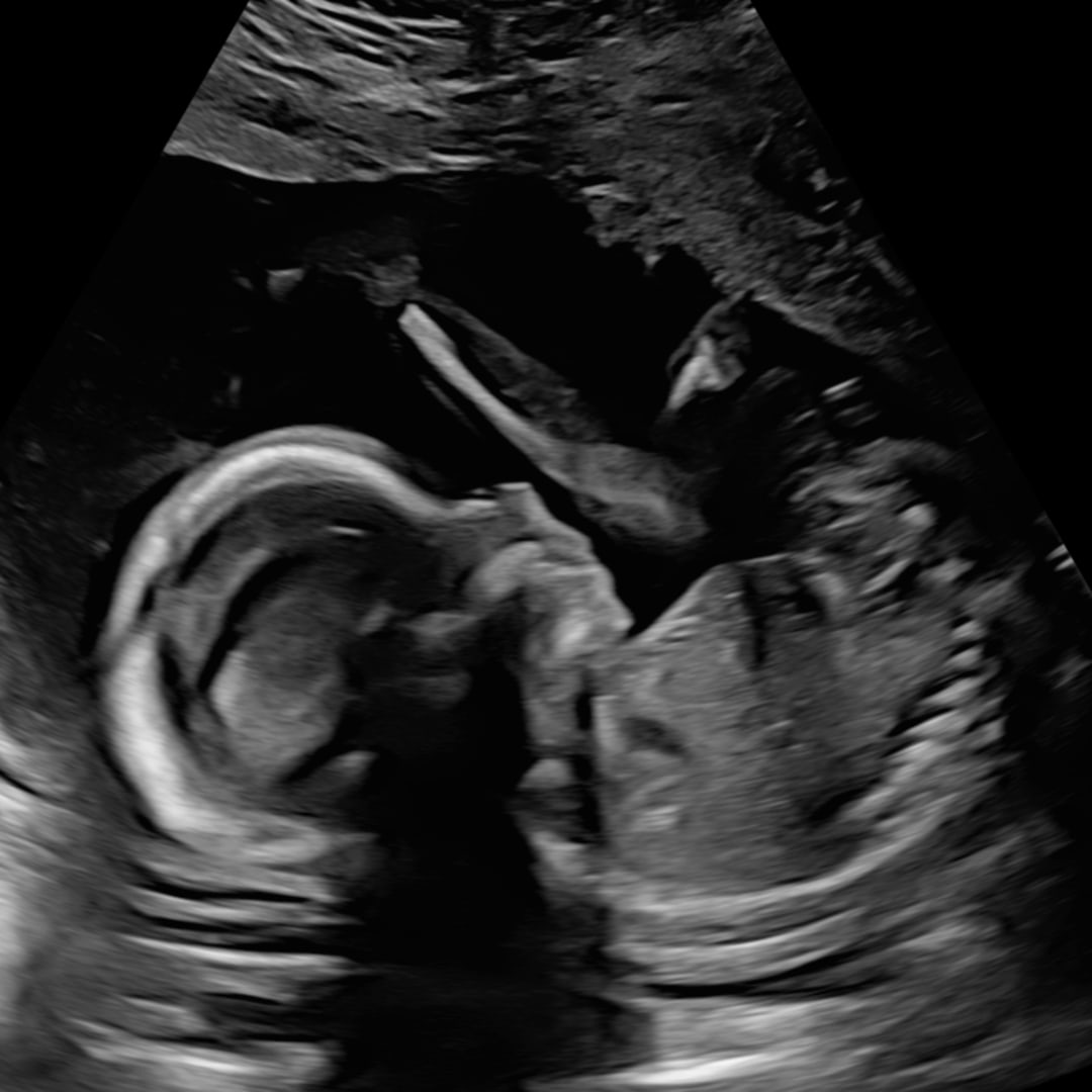 Photo shared by Daisy for their Babylist baby registry.