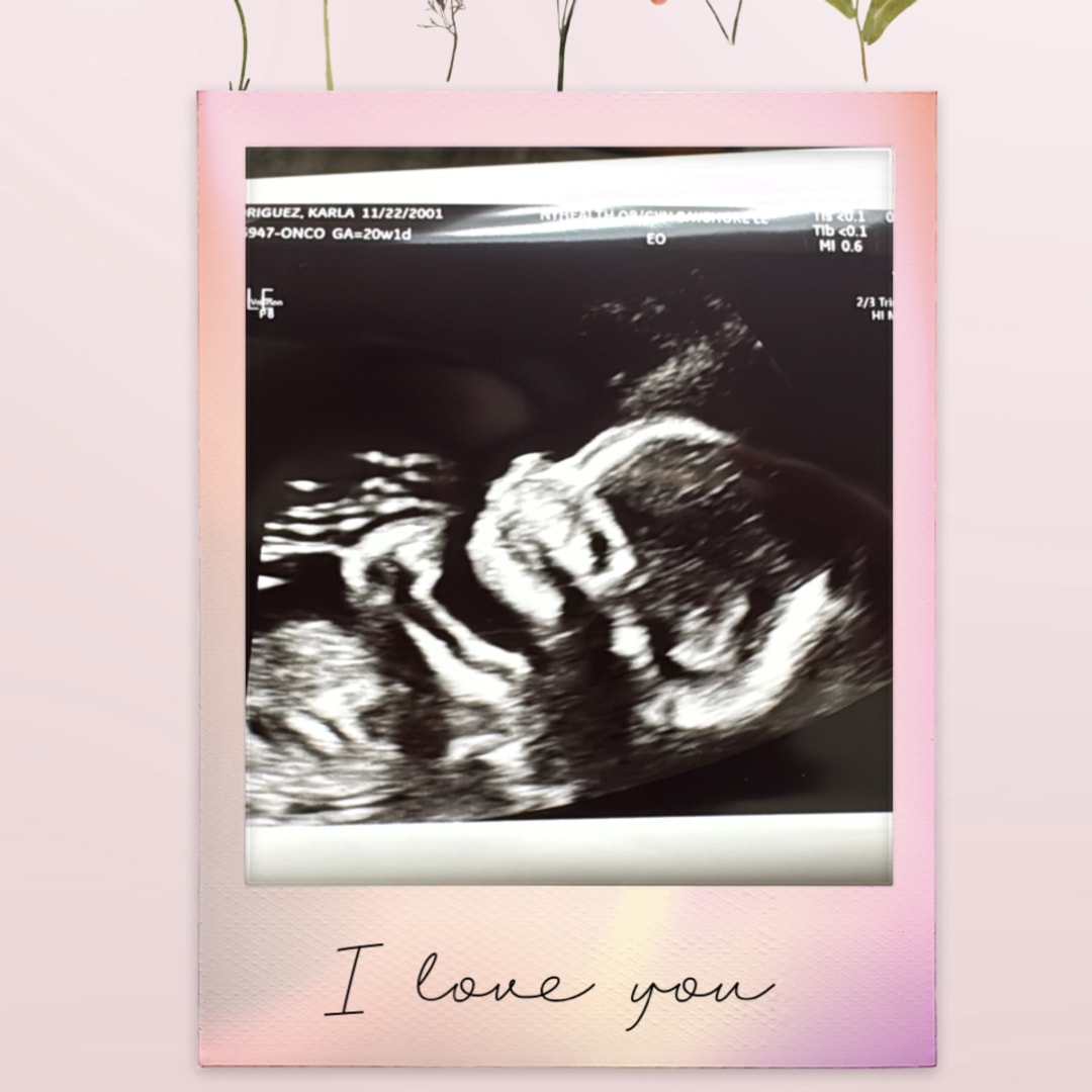 Photo shared by Karla for their Babylist baby registry.