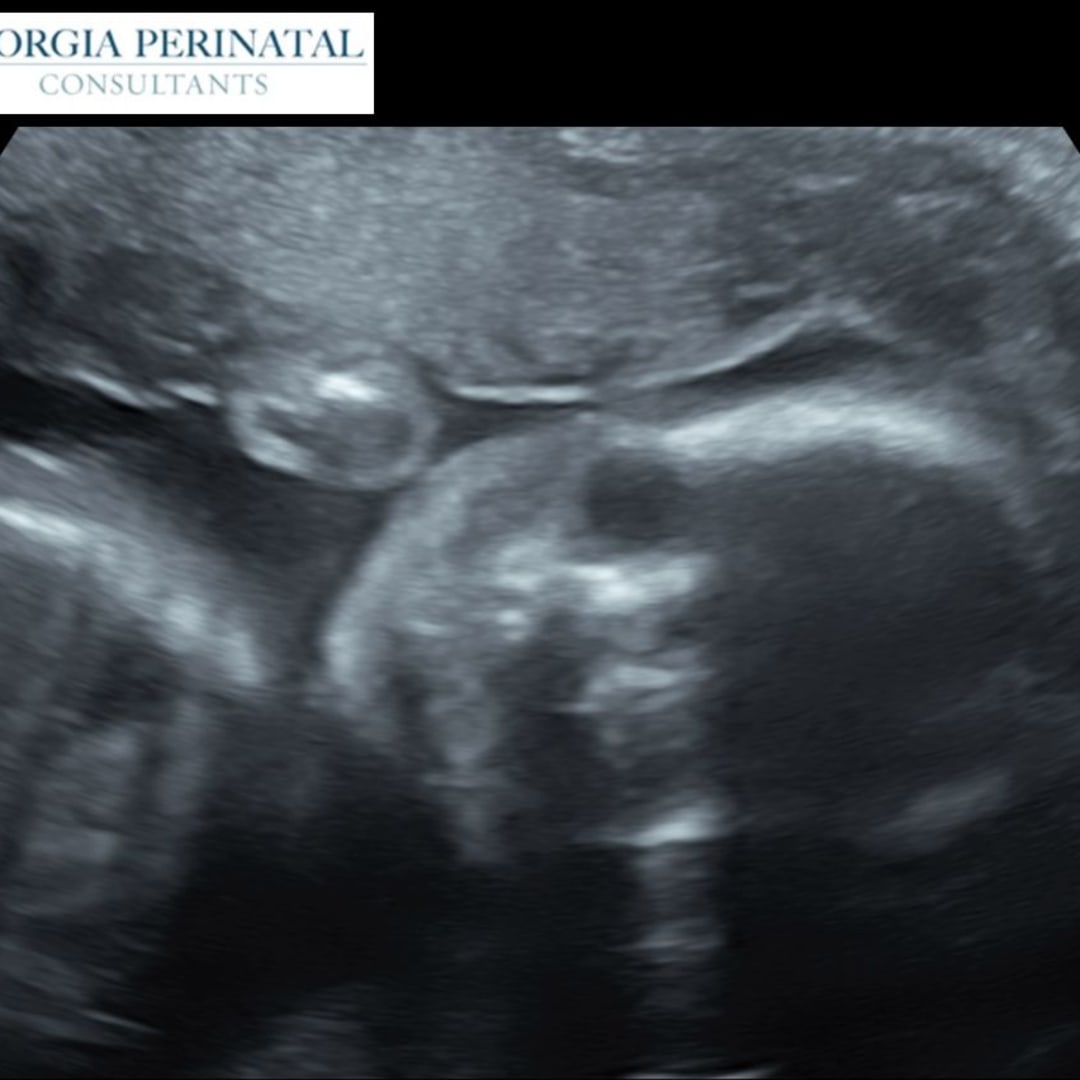 Photo shared by Britney for their Babylist baby registry.