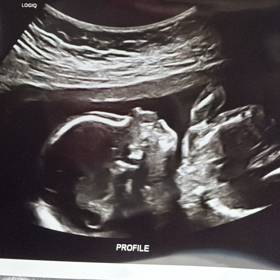 Photo shared by Bella for their Babylist baby registry.