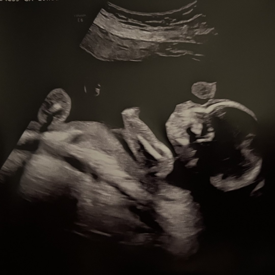Photo shared by Angela for their Babylist baby registry.