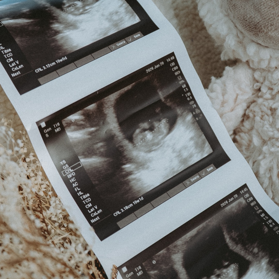 Photo shared by Mackenzie for their Babylist baby registry.