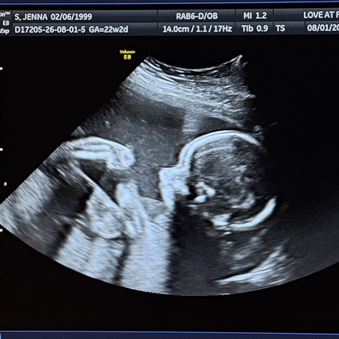 Photo shared by Jenna for their Babylist baby registry.