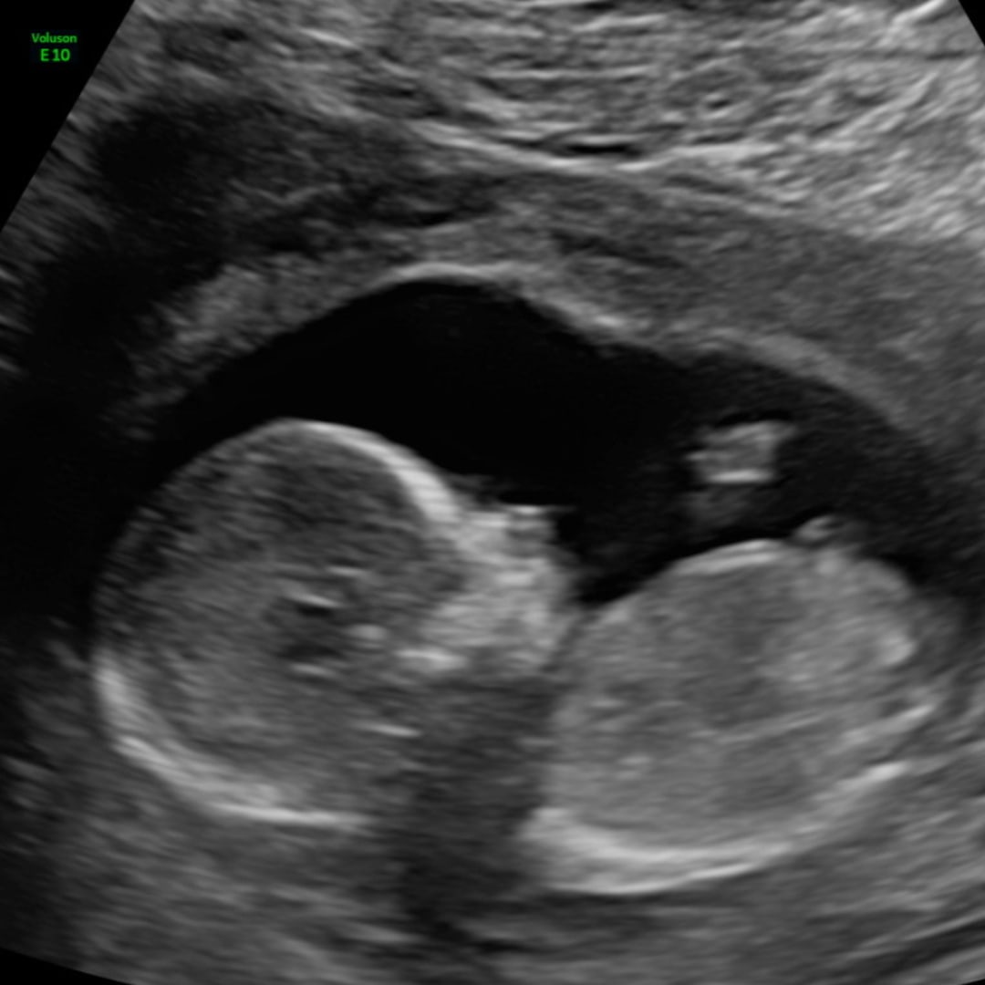Photo shared by Alex for their Babylist baby registry.