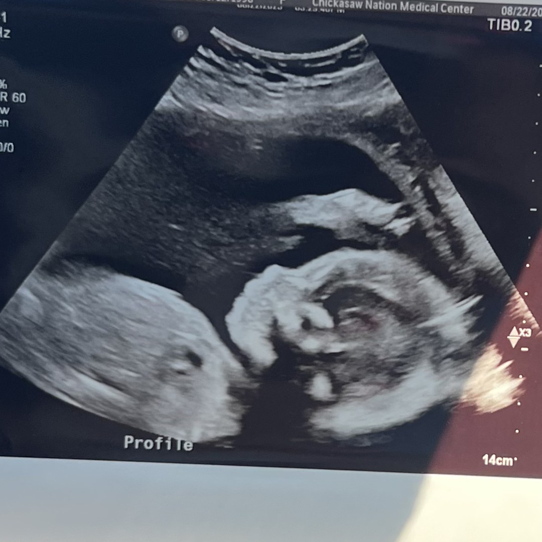 Photo shared by Kenzi for their Babylist baby registry.