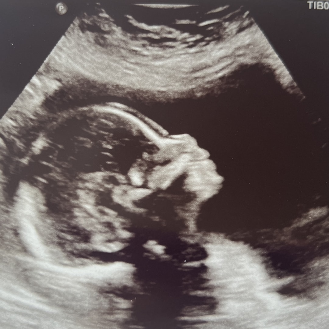 Photo shared by Trevor for their Babylist baby registry.
