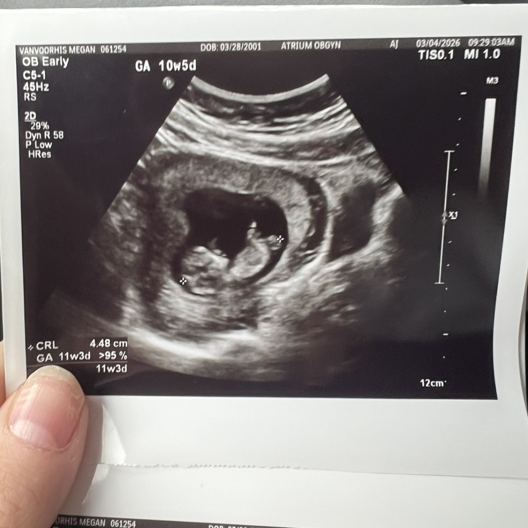Photo shared by Megan for their Babylist baby registry.