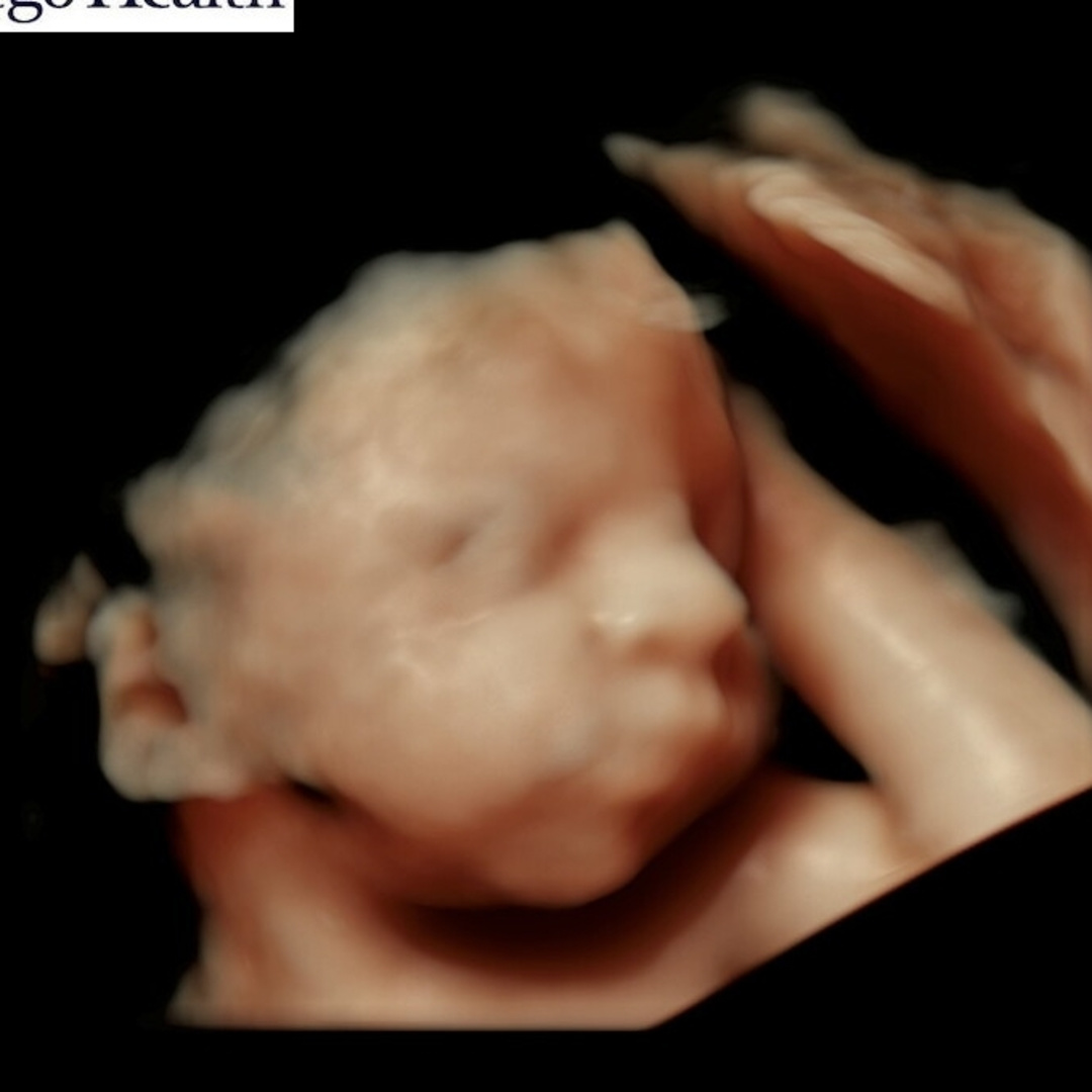 Photo shared by Erika for their Babylist baby registry.
