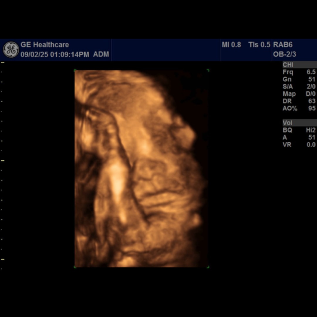 Photo shared by Sarah for their Babylist baby registry.