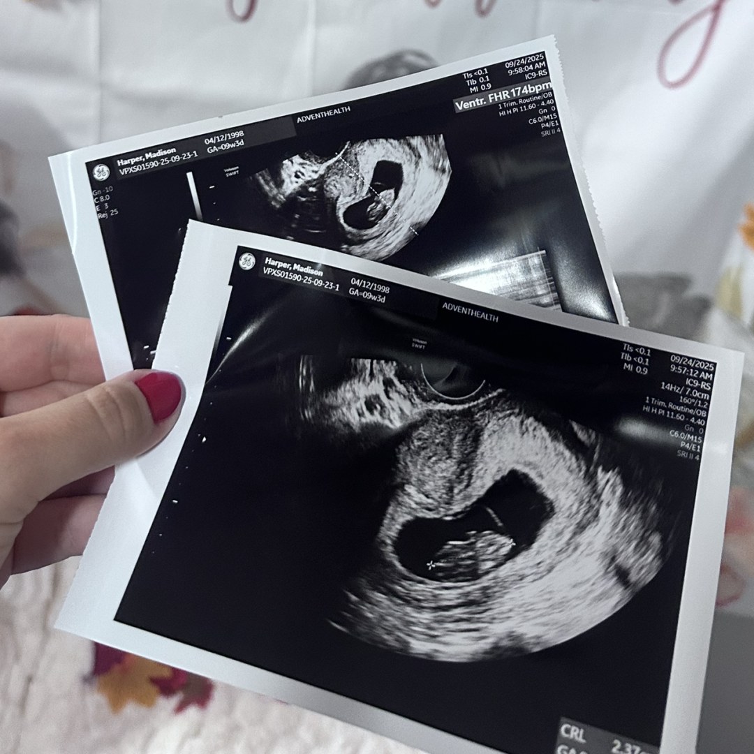 Photo shared by Maddie for their Babylist baby registry.