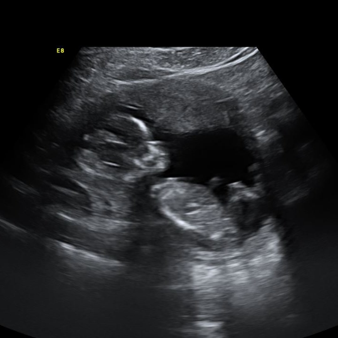 Photo shared by Izabella for their Babylist baby registry.