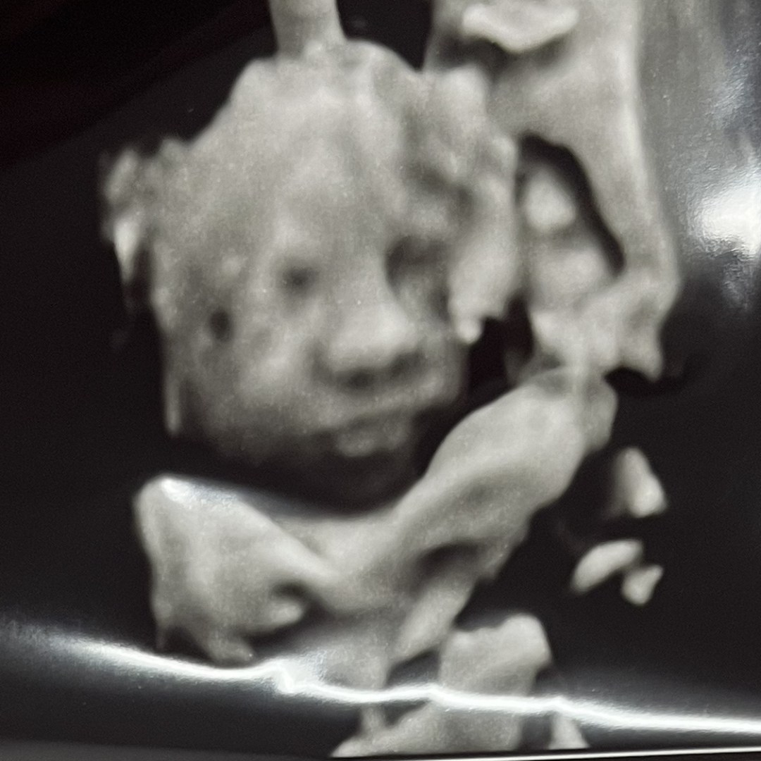 Photo shared by Melissa for their Babylist baby registry.