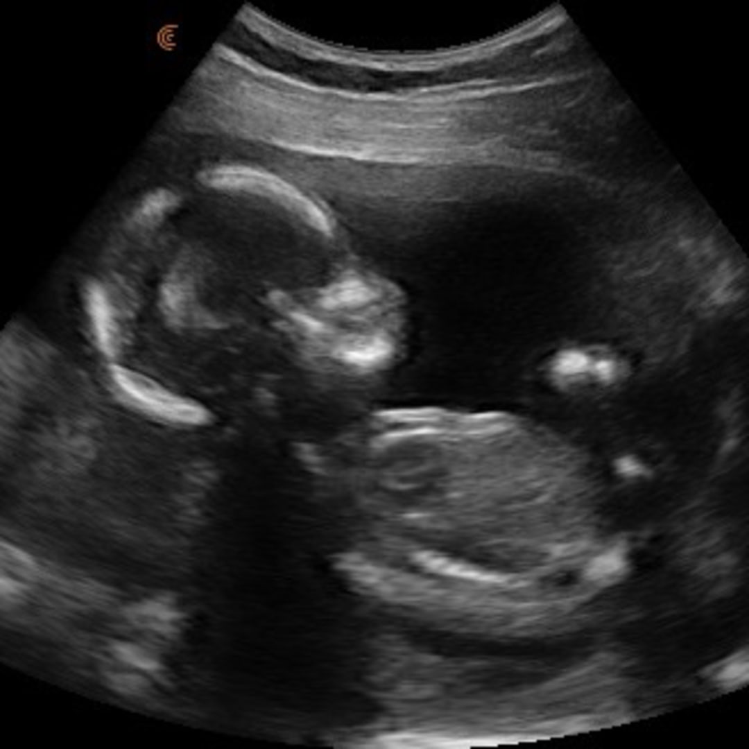 Photo shared by Lili for their Babylist baby registry.