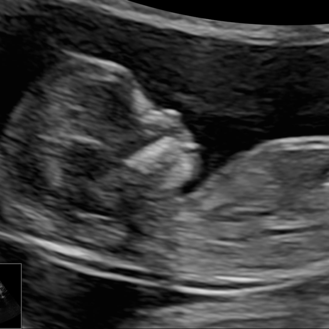 Photo shared by Alexia for their Babylist baby registry.