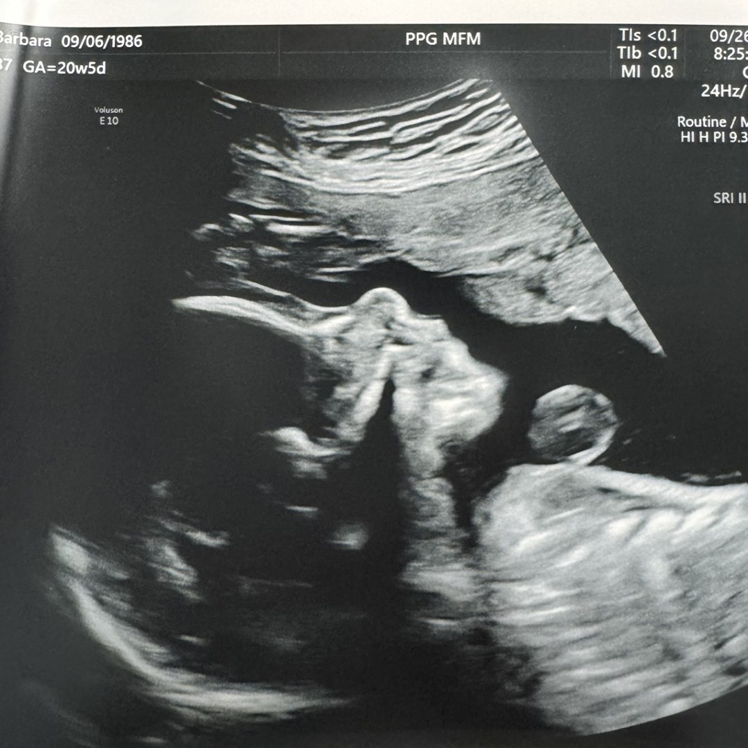Photo shared by Barbara for their Babylist baby registry.