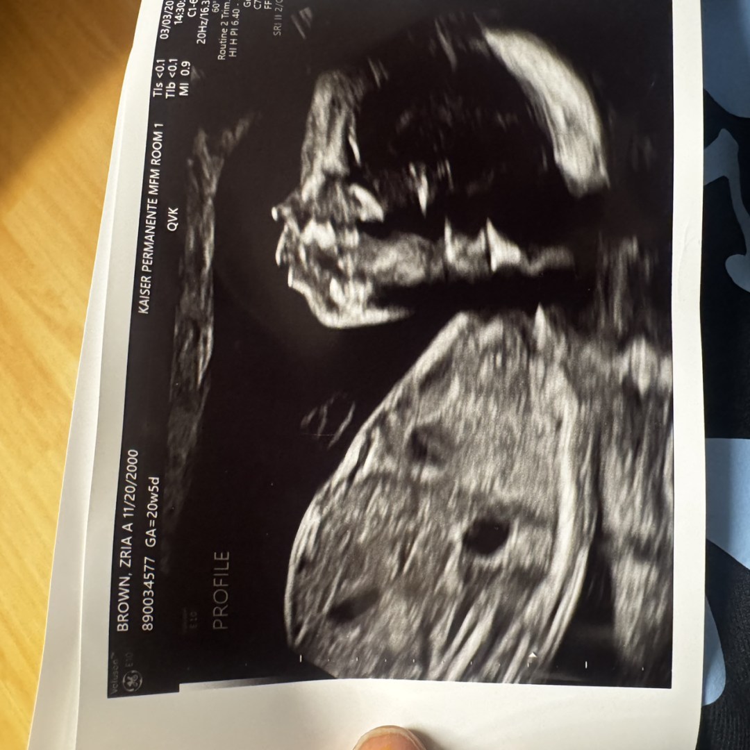 Photo shared by Z'ria for their Babylist baby registry.