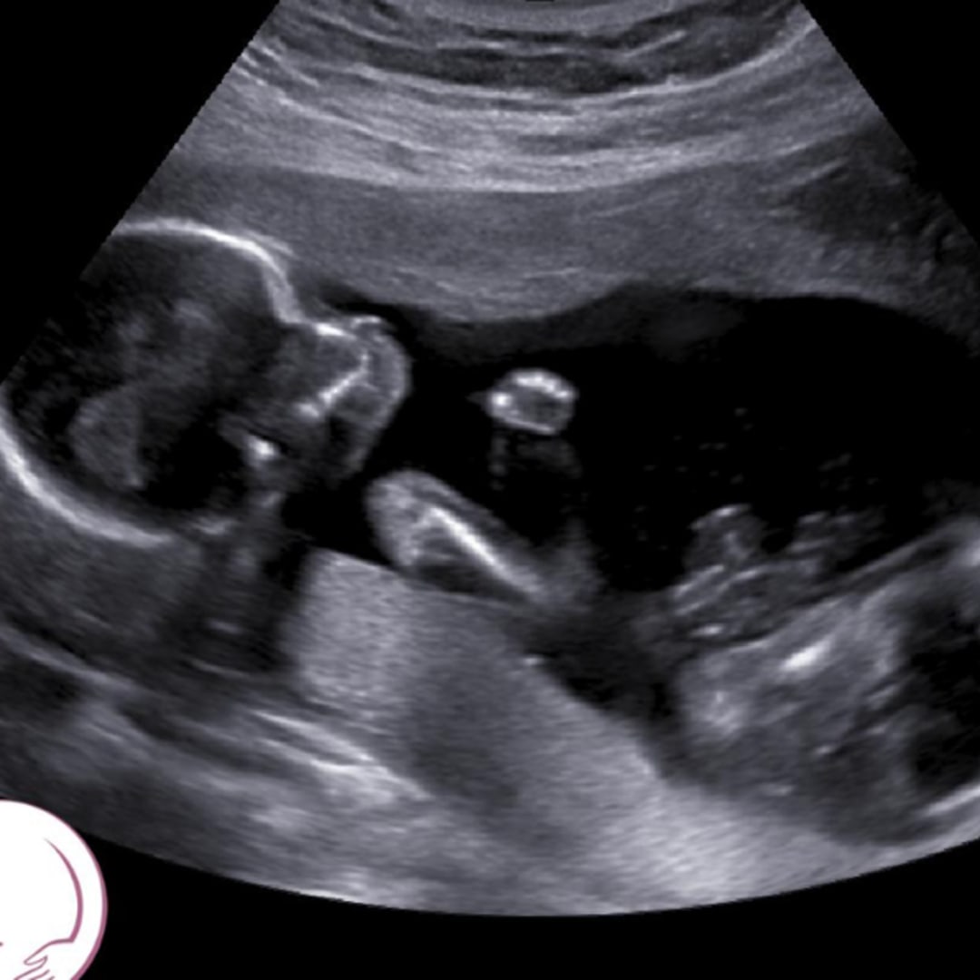 Photo shared by Ashley for their Babylist baby registry.