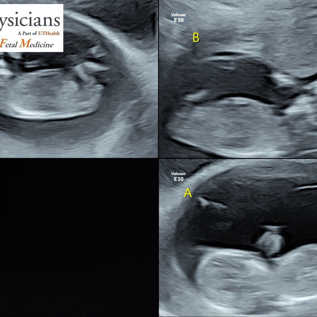 Photo shared by Eunice for their Babylist baby registry.