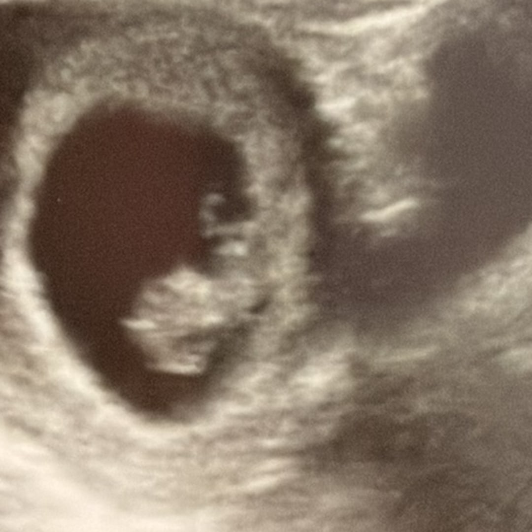 Photo shared by Veronica for their Babylist baby registry.
