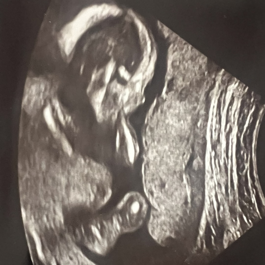 Photo shared by Kimberly for their Babylist baby registry.