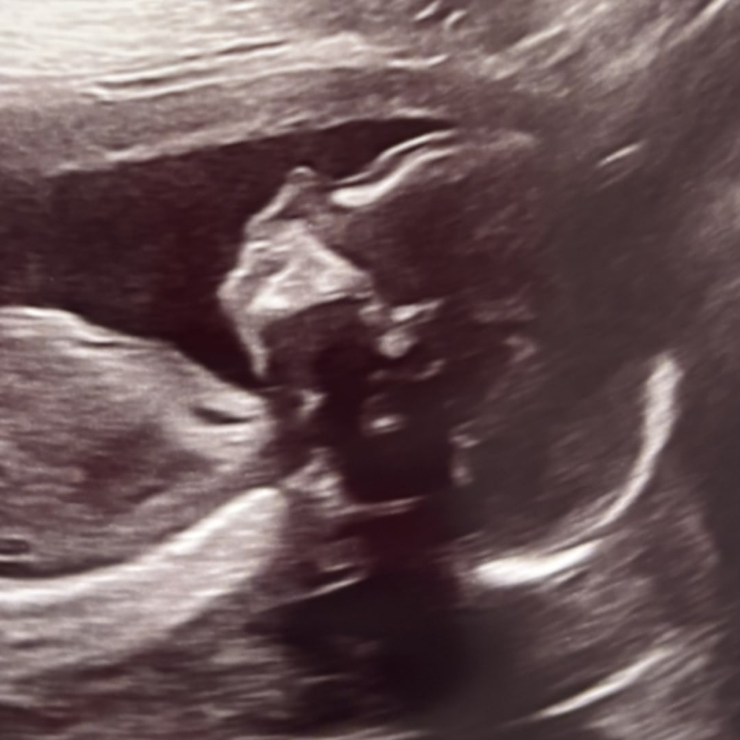 Photo shared by Hannah for their Babylist baby registry.