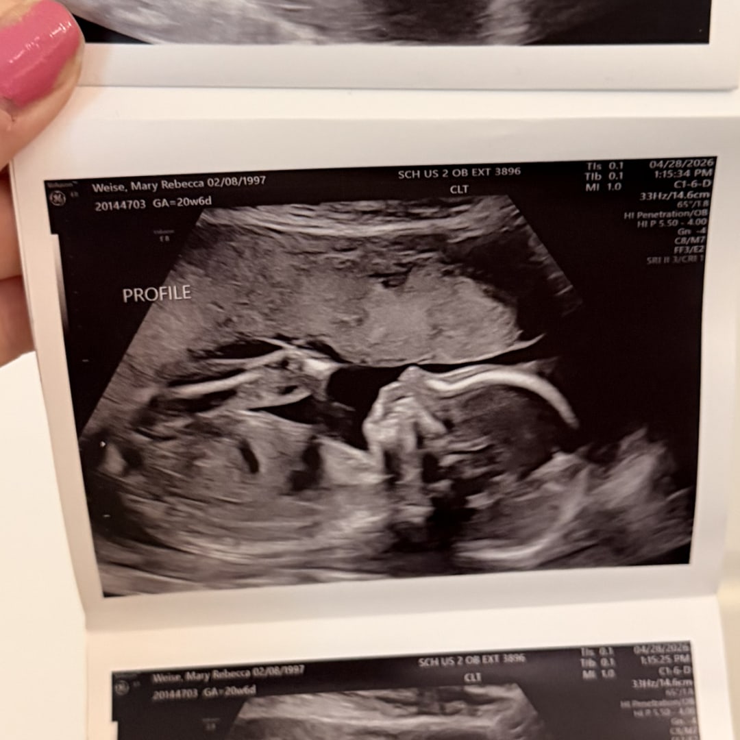 Photo shared by Rebecca for their Babylist baby registry.