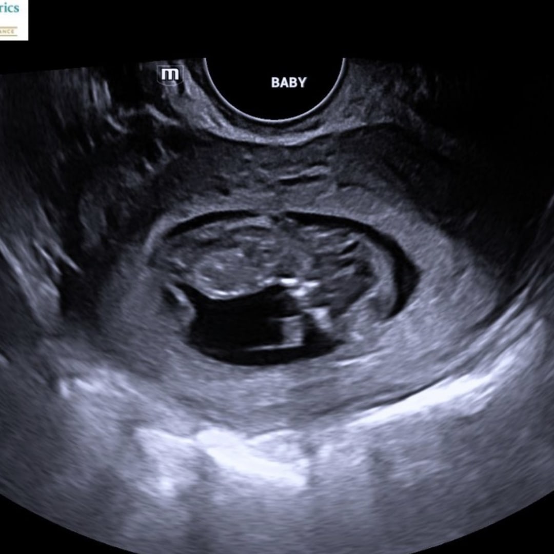 Photo shared by Melody for their Babylist baby registry.