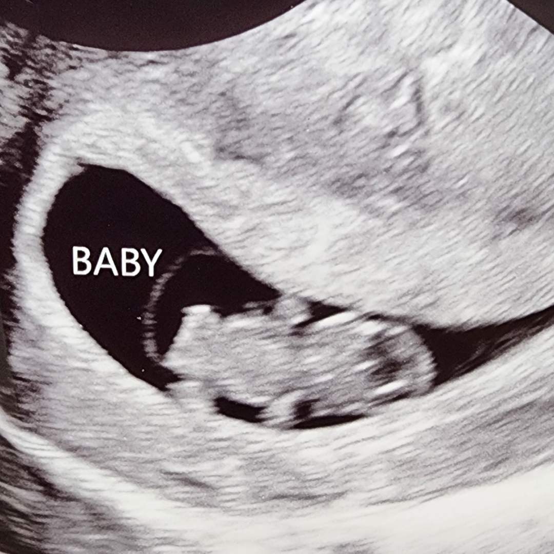 Photo shared by Kate for their Babylist baby registry.