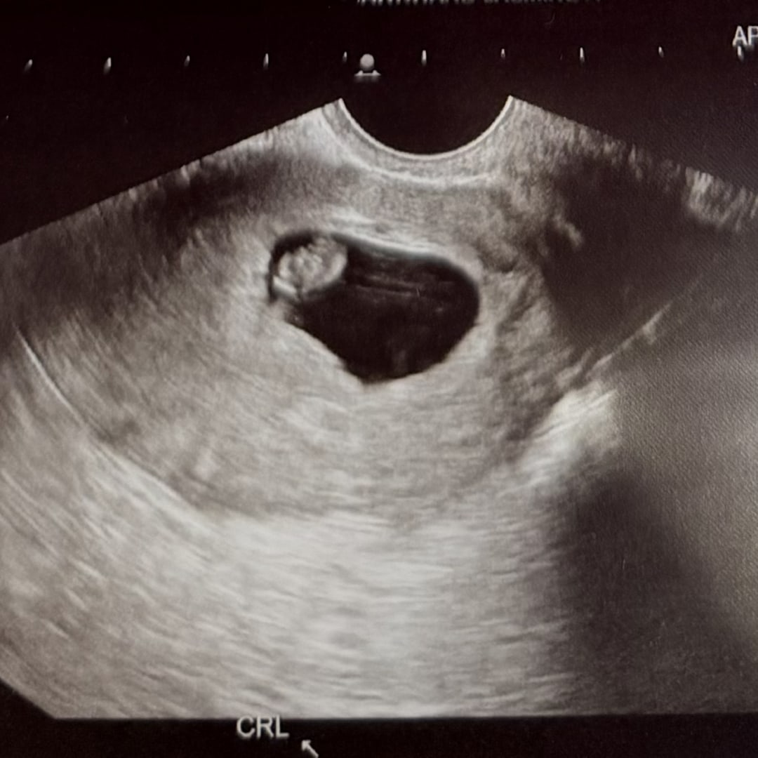 Photo shared by Jasmine for their Babylist baby registry.