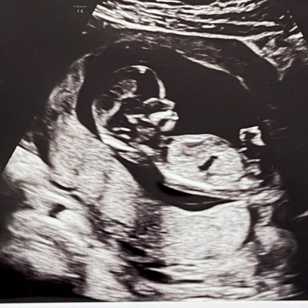 Photo shared by Chris & Elizabeth for their Babylist baby registry.