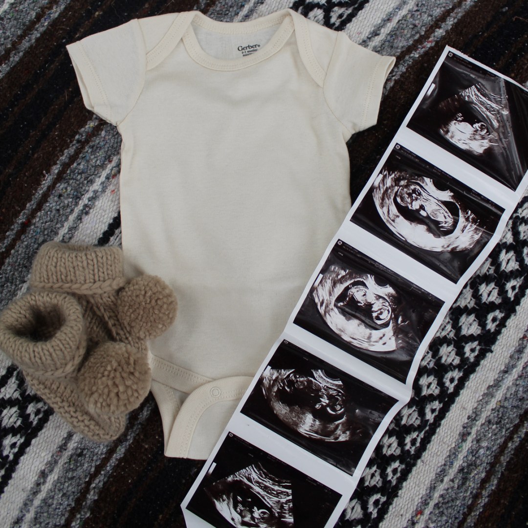 Photo shared by Imari for their Babylist baby registry.