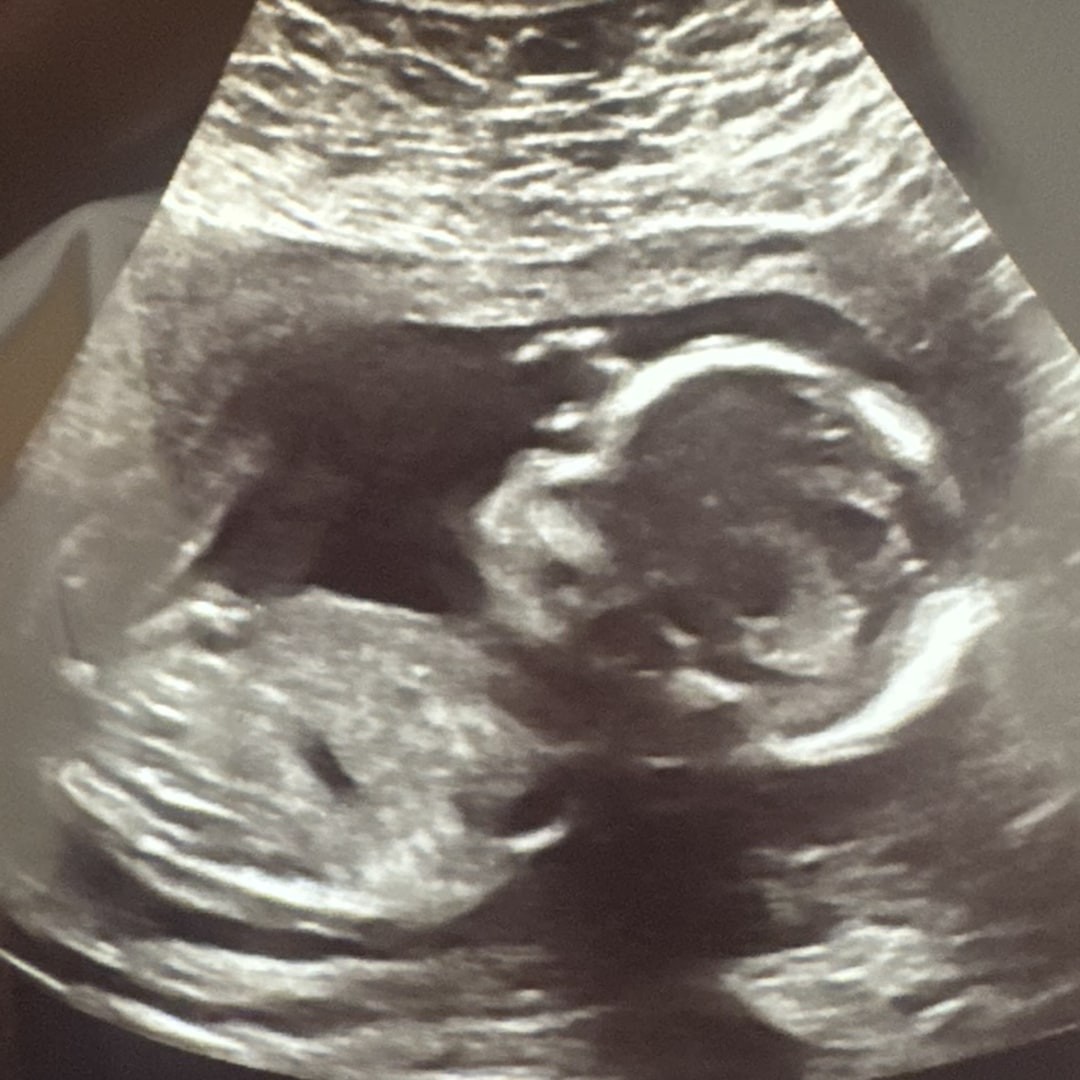 Photo shared by Elsie for their Babylist baby registry.