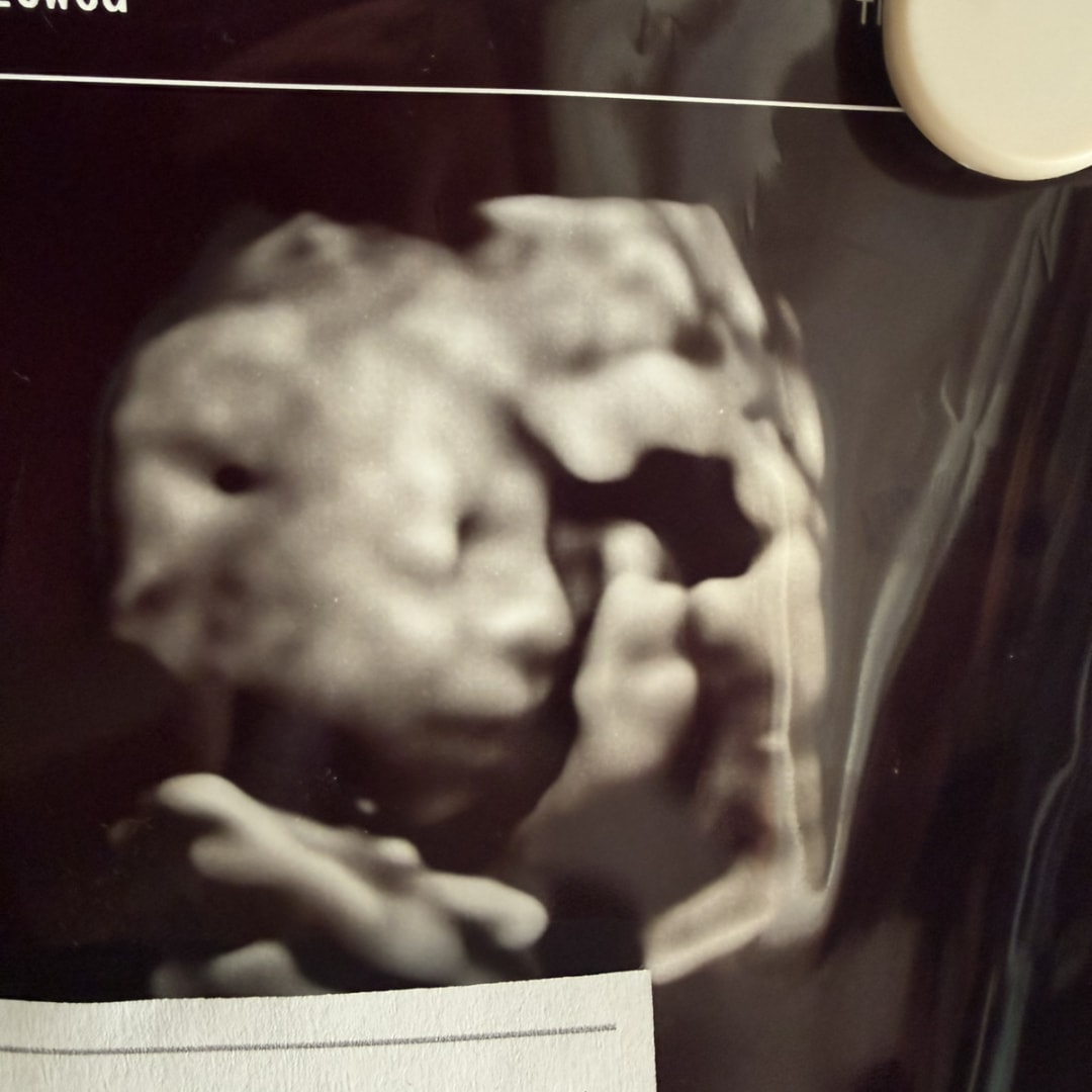 Photo shared by Hadley for their Babylist baby registry.