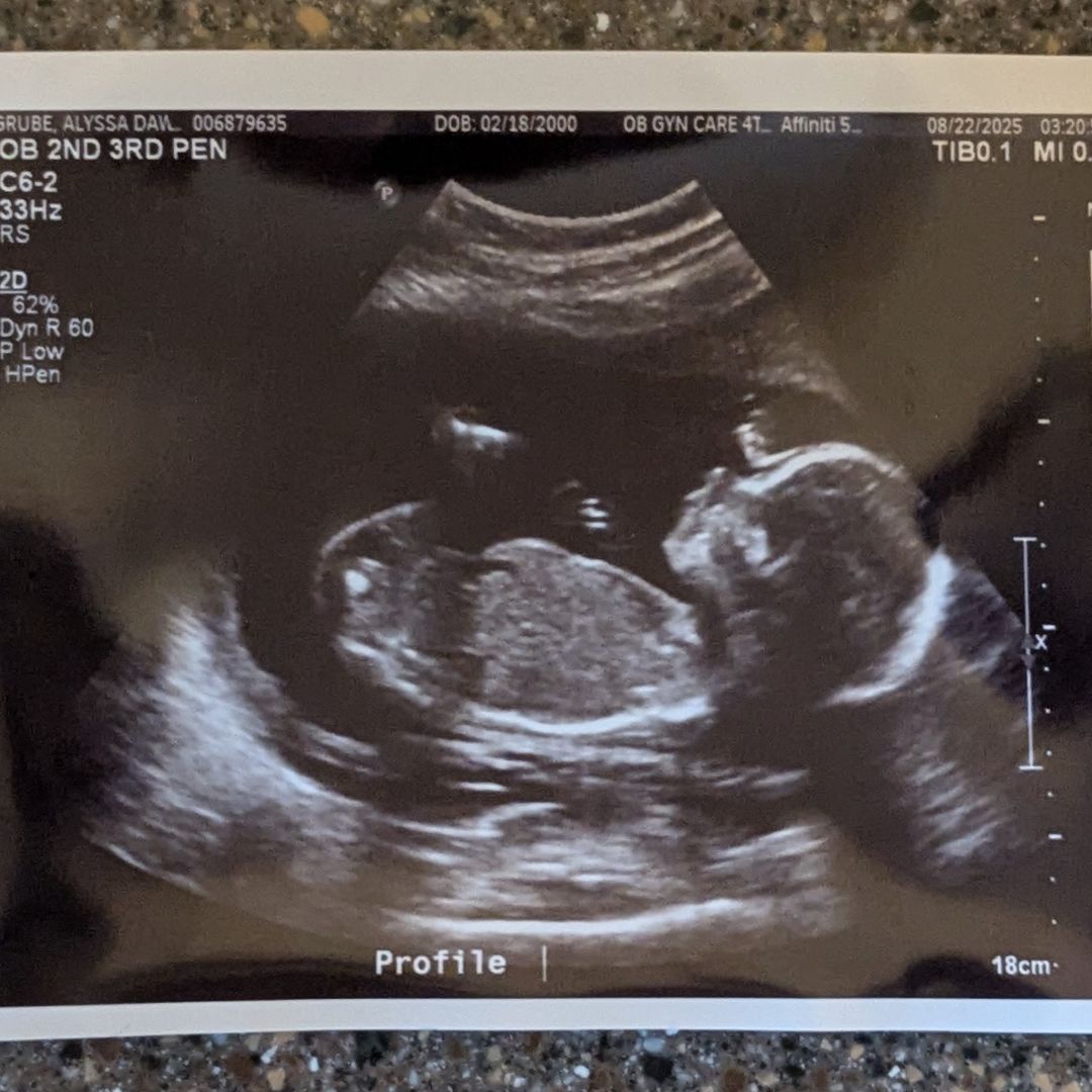 Photo shared by Alyssa for their Babylist baby registry.
