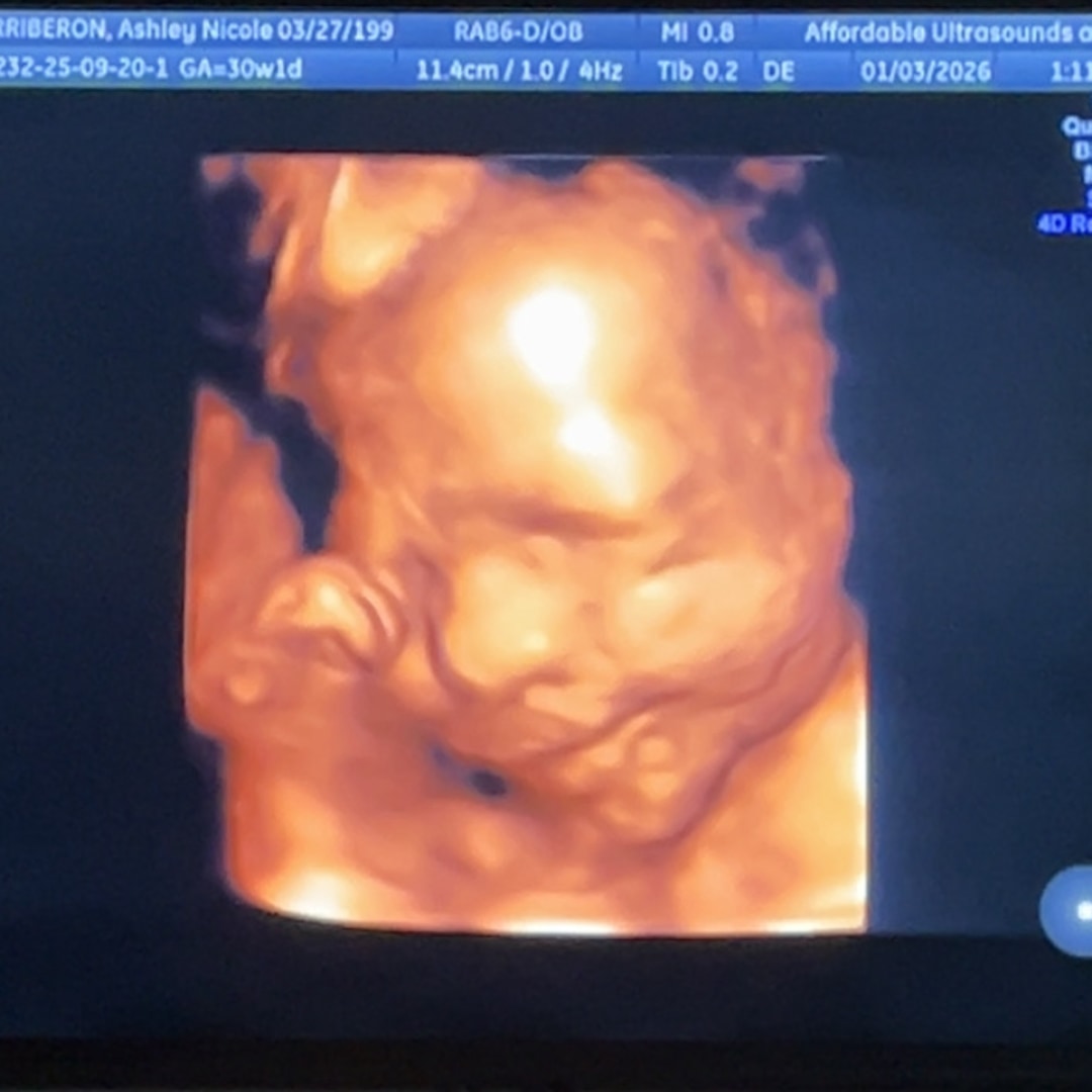 Photo shared by Ashley for their Babylist baby registry.