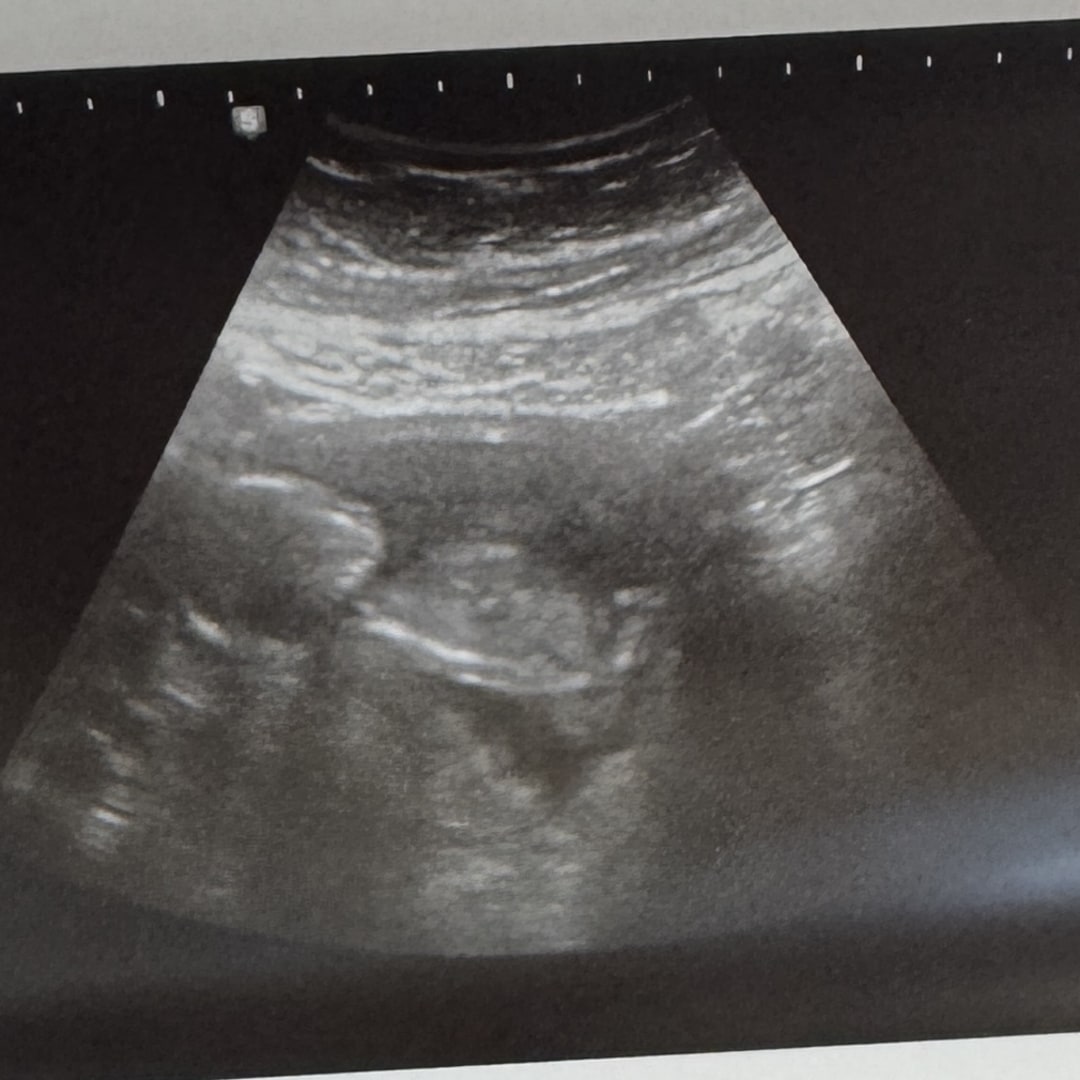 Photo shared by Haili for their Babylist baby registry.