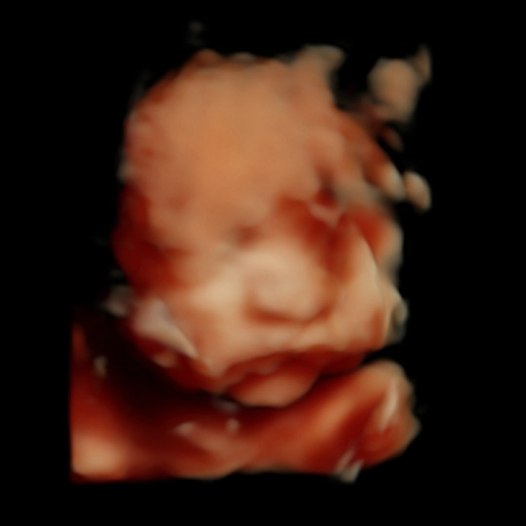 Photo shared by Alyssa for their Babylist baby registry.